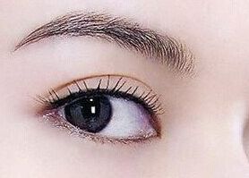 南充去眼袋哪家醫(yī)院好？專家推薦解決眼袋困擾的南充醫(yī)院排行榜