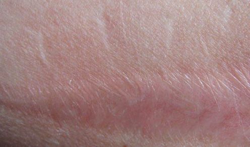 嘉興有哪些專業(yè)的醫(yī)美機(jī)構(gòu)提供雙眼皮手術(shù)？