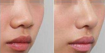 溫州和平整形醫(yī)院有哪些主要項目呢？