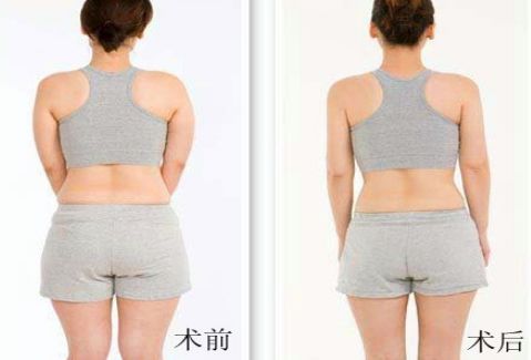 洛陽雙眼皮好的醫(yī)院有哪些？