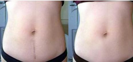 成都眼袋整形醫(yī)院哪家好？選擇專業(yè)整形醫(yī)院護你年輕無眼袋