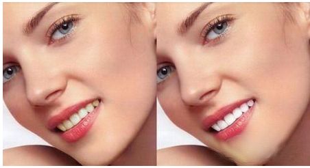 樸正國(guó)正頜手術(shù)有哪些風(fēng)格審美？