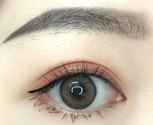 成都哪家美容醫(yī)院的埋線減肥效果好？