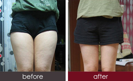 2023宜春玻尿酸豐鼻唇溝手術(shù)權(quán)威專家排行前幾(趙杰發(fā)、牛永敢、陳希琳技術(shù)效果好)