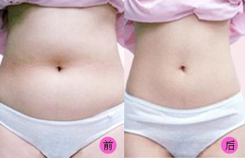 【2023吉林雙眼皮手術(shù)評測】哪家醫(yī)院值得信賴？