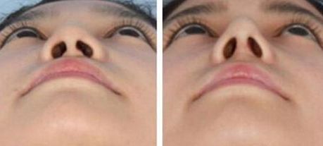 衢州做小手術(shù)哪家醫(yī)院好？快速推薦衢州當(dāng)?shù)貙?zhuān)業(yè)的醫(yī)院