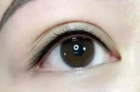 馬桂娥面頰填充脂肪能打造自然輪廓，挺陽高效！醫(yī)生背景介紹必讀！