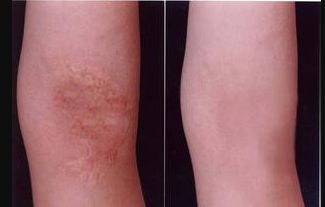 廈門哪家醫(yī)院整鼻子效果好，選擇哪家醫(yī)院才能安心？