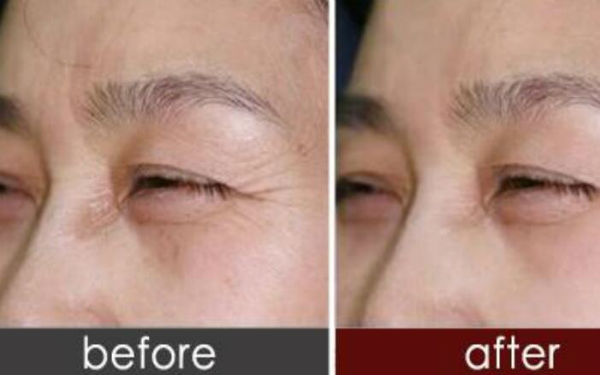 上海肋骨鼻哪位專家技術(shù)過硬？人氣牛仔鼻醫(yī)生排名大曝光！