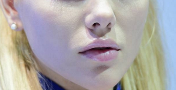 2023烏魯木齊肚子射頻溶脂在榜名單前十位醫(yī)生(劉艷、洪喬茵、張弘業(yè)讓整形更有保障)