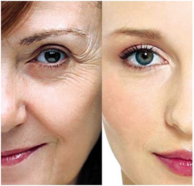 上海哪家醫(yī)院做去眼袋手術(shù)效果好？