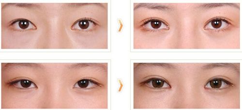 2023杭州瘦腿針注射醫(yī)生排名10強(qiáng)(劉洋、程麗、陳笑獲得網(wǎng)友極力推薦)