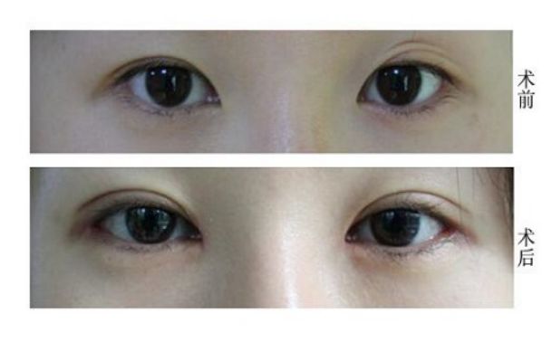 天津修復(fù)唇腭裂的醫(yī)院哪家好？專業(yè)解讀！