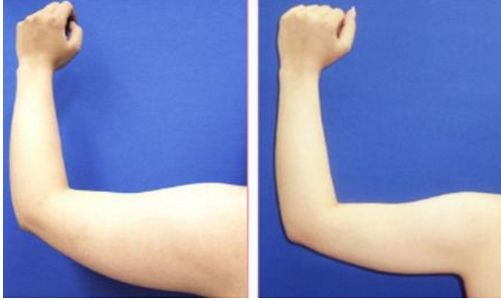 重慶整形美容醫(yī)院哪家好？最權(quán)威的整形美容醫(yī)院盤點(diǎn)