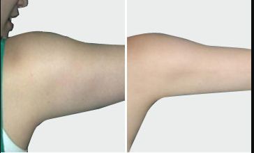 上海中國去疤痕醫(yī)院哪家好？高效去除疤痕的專業(yè)醫(yī)院推薦