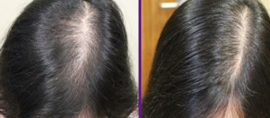 重慶小臂抽脂醫(yī)院排行榜TOP10，專業(yè)技術(shù)解析！