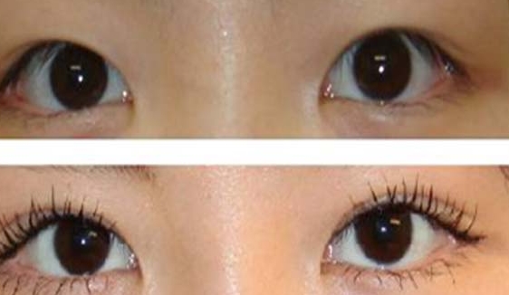 【限時優(yōu)惠】深圳美萊梁志：專業(yè)修復(fù)鼻子技術(shù)驚艷一覽！