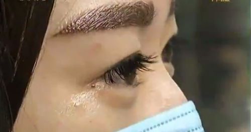 武漢招風(fēng)耳矯正哪家好？尋找專業(yè)耳部矯正專家的最佳選擇