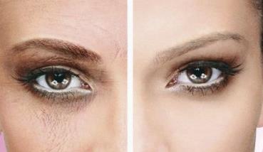 2023貴州靜態(tài)紋手術(shù)祛除權(quán)威專家排行前十強(qiáng)(胡紹洪、張媛、孫超這些專家名單看到就是賺到)