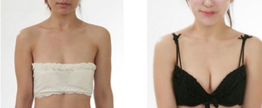 大連市做雙眼皮哪家好？了解大連市雙眼皮手術(shù)的費用、效果和口碑