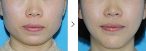 深圳哪家去色斑醫(yī)院好？專家推薦這些知名醫(yī)療機構