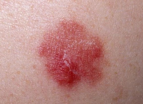 北京鼻修復(fù)醫(yī)生評價：劉彥軍、薛軼群技術(shù)對比，附價格一覽