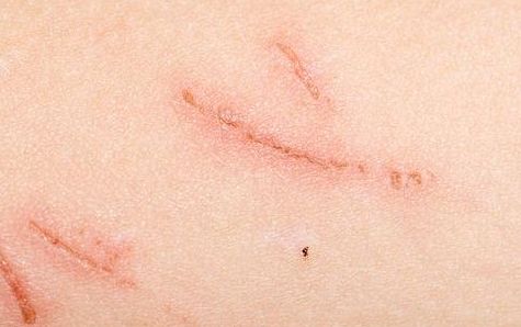 南陽市拉皮除皺手術哪家好？選擇何種醫(yī)院更安心？