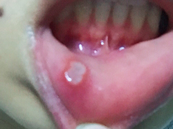 2023宜春注射瘦臉瘦小腿top10醫(yī)生(王小麗、鄒琪、羅玉娟看到就是賺到)