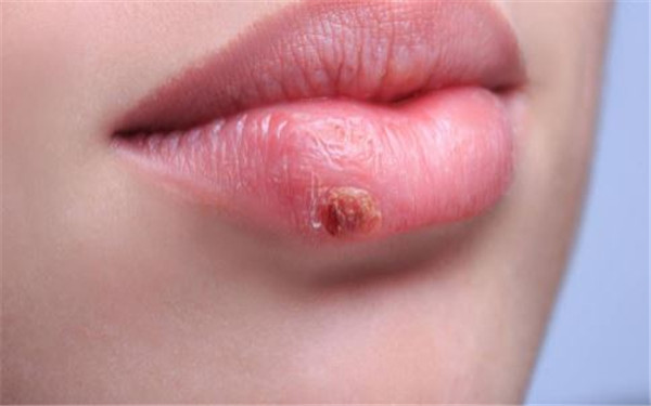 2023河南消除額頭紋專家排行前十(茹江江、朱卉、張會(huì)霞排行榜前三名官方認(rèn)證！)