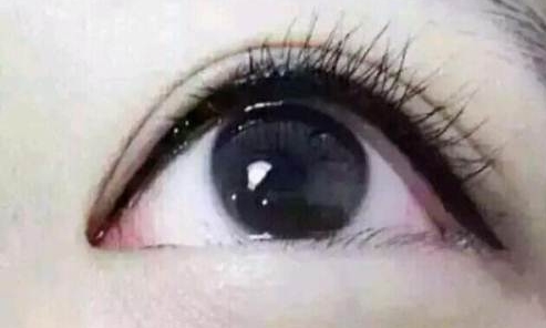 廣州曙光醫(yī)學美容醫(yī)院的黎凍抗衰老療法有多出色？