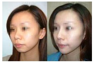 秦皇島美容美體哪家好？刷爆朋友圈的秘密美容院大揭秘！