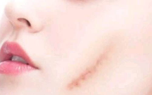 濰坊哪家醫(yī)院做抽脂整形好，服務(wù)好口碑好？