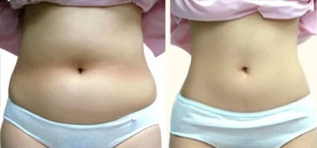 上海哪家醫(yī)院做美容手術(shù)好？——選擇上海做美容手術(shù)醫(yī)院的首選方案