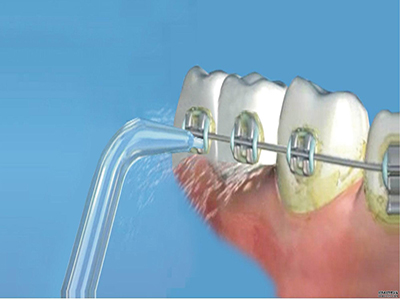 2023大連針雕祛除口周紋排名前幾的專家(孫妍娜、楊曉英、王殿峰價格不貴還親民)