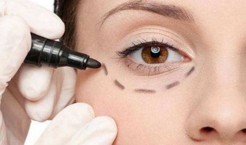 深圳分體式隱形隆鼻醫(yī)院十強榜單揭曉！