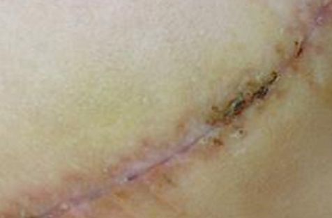 重慶去斑好的醫(yī)院哪家好？權(quán)威推薦，告訴您重慶著名的去斑治療醫(yī)院!