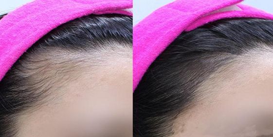 安陽(yáng)民營(yíng)整形醫(yī)院排名前三，哪家效果好的口碑最佳？