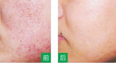 永州美辰醫(yī)療整形醫(yī)院的價(jià)格如何？收費(fèi)標(biāo)準(zhǔn)透明公開(kāi)，術(shù)前注意事項(xiàng)必看！