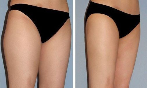 北京好的豐面部醫(yī)院哪家好？口碑最佳推薦！