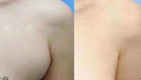 四惠中醫(yī)院植發(fā)技術(shù)之谷遠飛、王繼萍醫(yī)生介紹及價格表