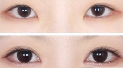 海口做隆鼻醫(yī)院哪家好？?？谀募艺葆t(yī)院的鼻部整形效果好且口碑贊？