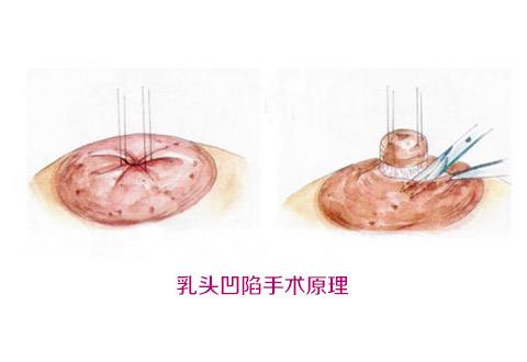 揭秘北京大學(xué)深圳醫(yī)院整形外科名醫(yī)團(tuán)隊(duì)！想了解吸脂案例嗎？來看這里！