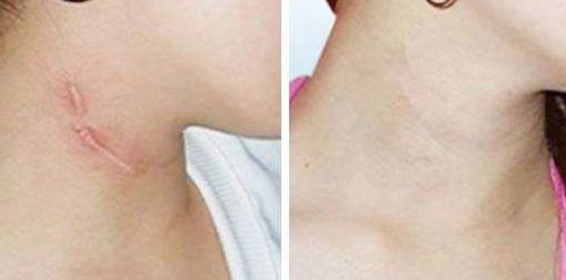 南京整形醫(yī)院哪家好又實(shí)惠？全面評(píng)估南京整容手術(shù)價(jià)格與口碑