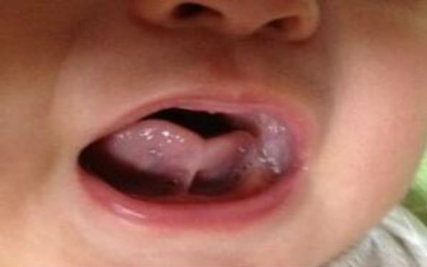 2023九江針雕去除頸紋專家口碑榜前十強(qiáng)(宗艷霞、郭善勇、郭仁洙收費(fèi)都不貴的)