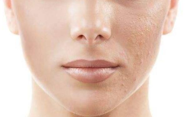 上海柴云做雙眼皮修復(fù)是否靠譜？體驗(yàn)如何？