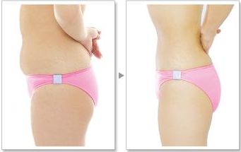 您在武漢協(xié)和醫(yī)院可以找到熱瑪吉嗎？預(yù)約技術(shù)嫻熟的醫(yī)生，口碑非常好！