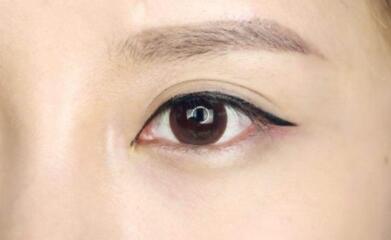 上海九院美容科的專家揭秘！魏皎、張余光、韋敏醫(yī)生值得信賴嗎？附磨顴骨體驗分享