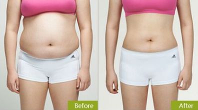 合肥祛眼袋，如何選擇最適合的醫(yī)院？