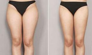 合肥祛痘效果最好的醫(yī)療美容機(jī)構(gòu)有哪些？