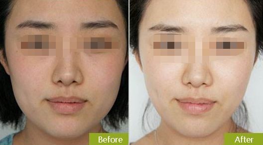 蘇州哪家整形外科醫(yī)院好？快速了解蘇州市頂級(jí)整形外科醫(yī)院推薦